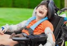 اليوم العالمي للشلل الدماغي.. تعرف على أعراض وأسباب المرض